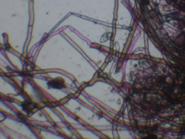 Geopora sumneriana ... in MICRO